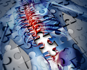 Difference Between an Incomplete and a Complete Spinal Cord Injury